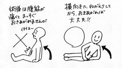 術後起き上がり方 Peer Ring なかまと話そう 女性特有のがん 術後起き上がり方 Peer Ring なかまと話そう 女性特有のがん