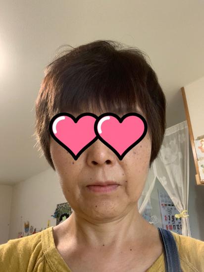 ラストケモから8カ月 Peer Ring なかまと話そう 女性特有のがん