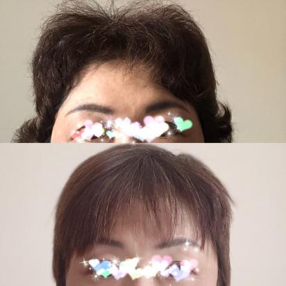 ピッピさんのダイアリー 脱ウィッグ 再発治療後 Peer Ring なかまと話そう 女性特有のがん